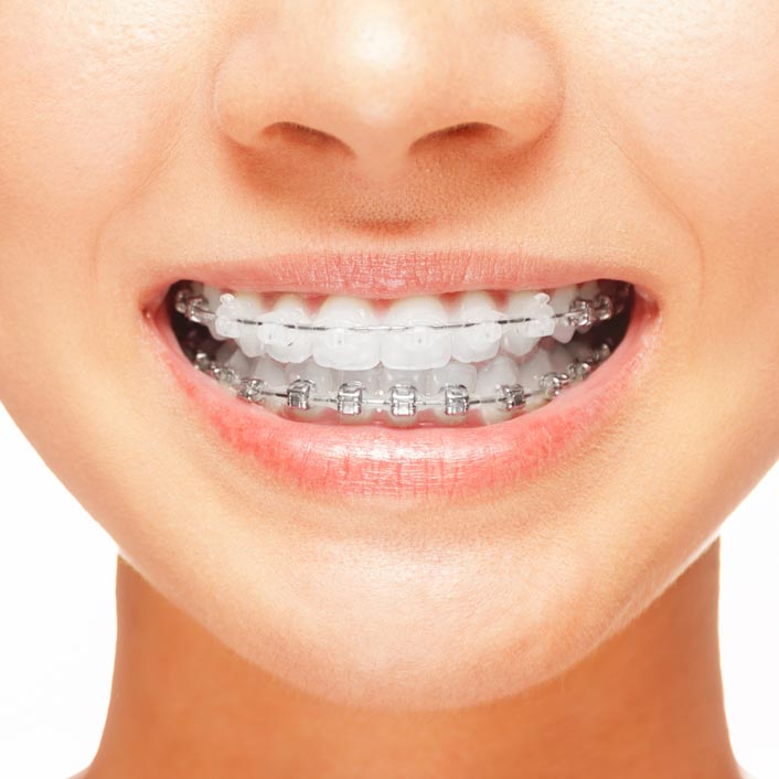 ORTHODONTICS